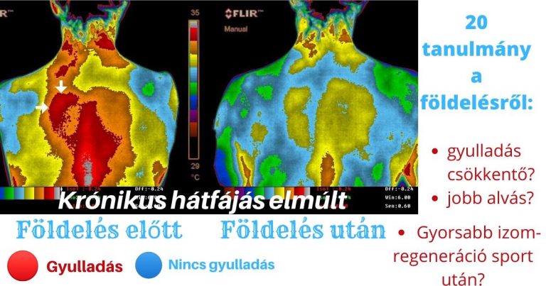 Földelés hatása a szervezetre