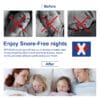Horkolás elleni Szájtapasz - SleepFix