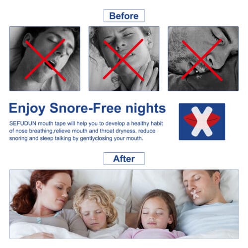 Horkolás elleni Szájtapasz - SleepFix