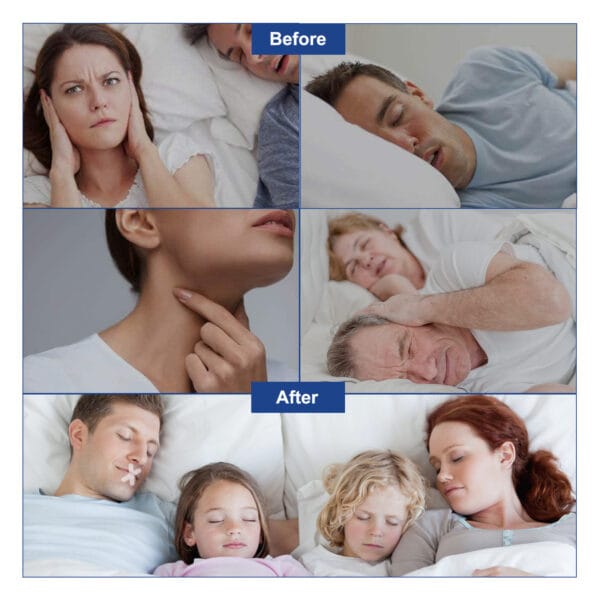 Horkolás elleni Szájtapasz - SleepFix
